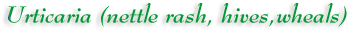 Urticaria (nettle rash, hives wheals)